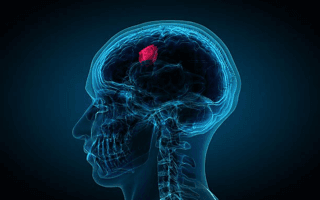 Brain Tumour Segmentation